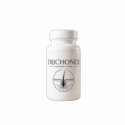 Trichonex — Zdjęcie: 5